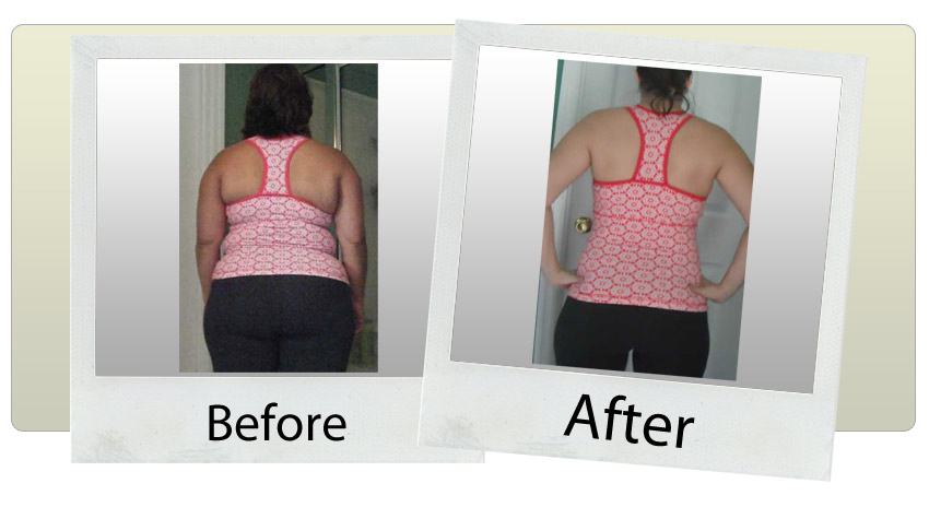 hcg diet before after hcg diet before after photos